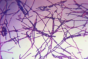 800px-Bacillus_anthracis_Gram