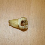 John Lennon's tooth