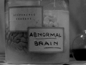 frankenstein-abnormal-brain