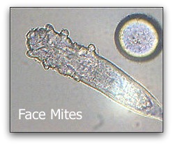 Face Mites